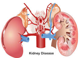 11 symptoms and signs of kidney failure